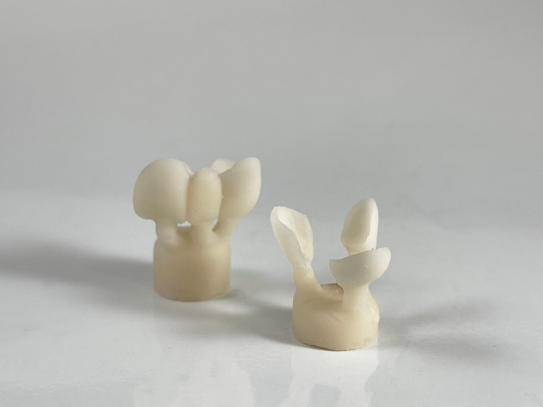 Pressed ceramic restoration