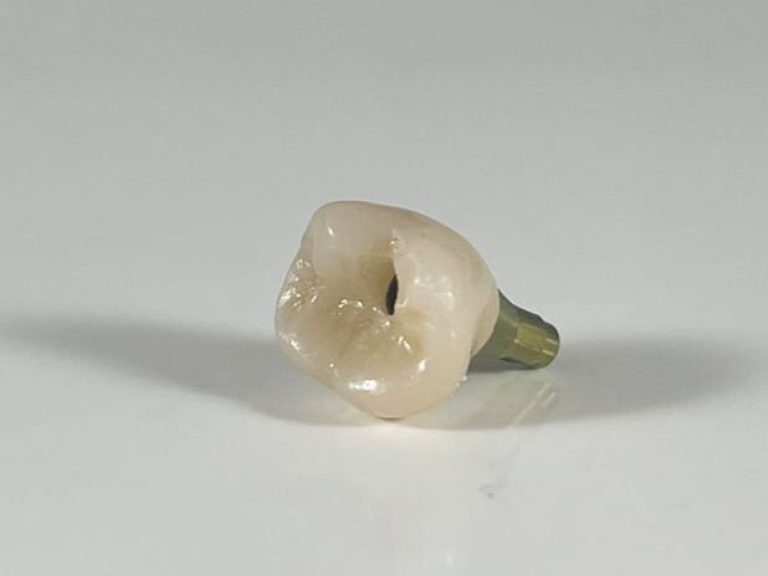 Screw-retained implant crown