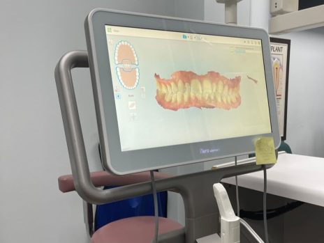 Intraoral scanner digital impression workflow