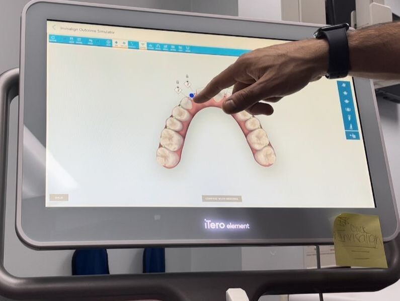 Digital dental scan data