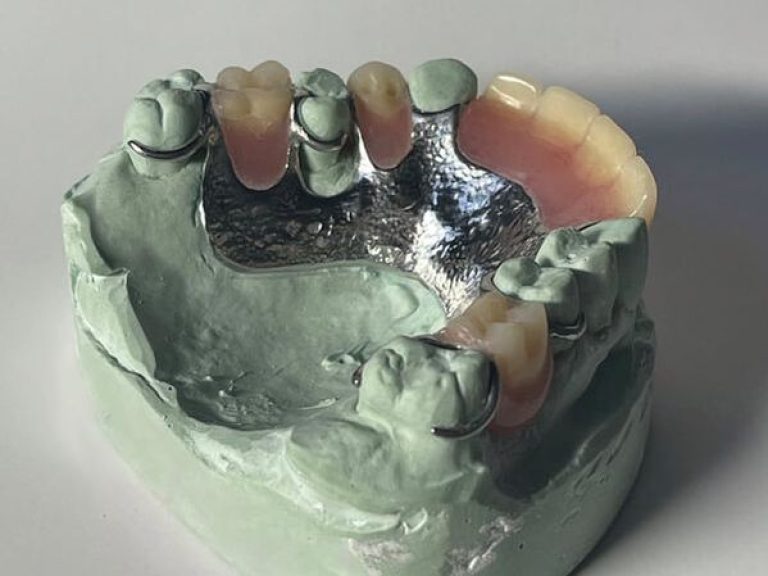Digital denture detail
