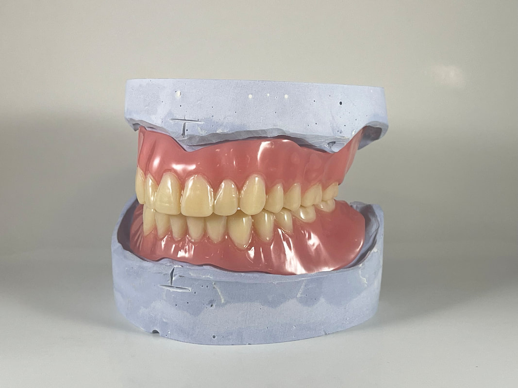 Removable dental restoration detail