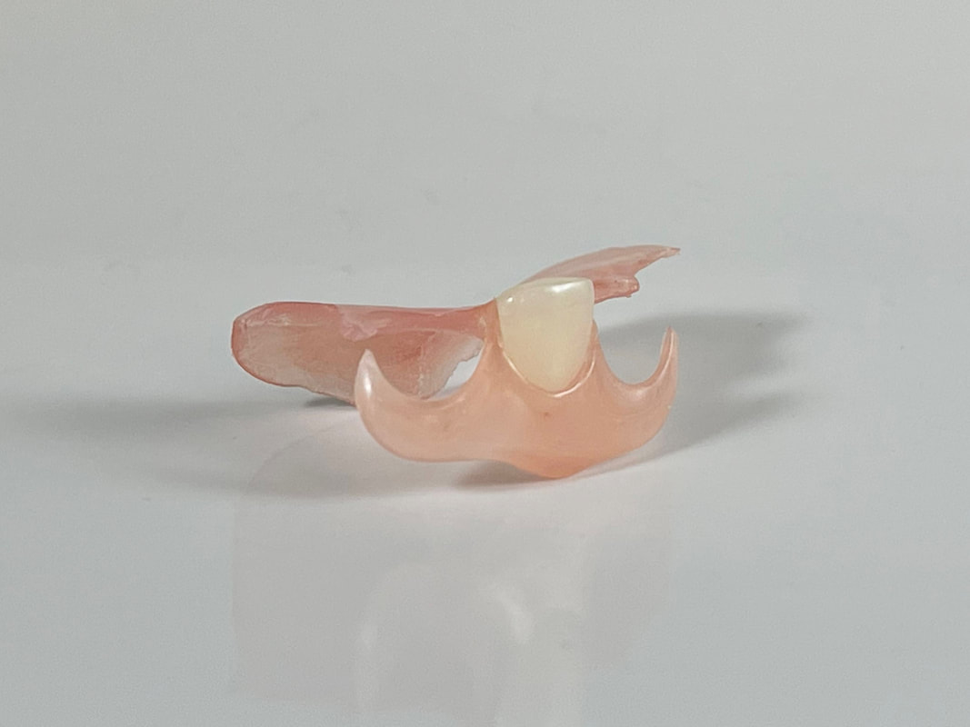Removable restoration craftsmanship