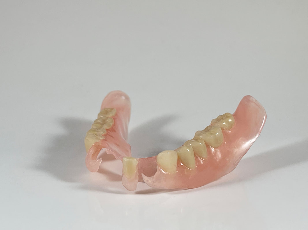 Dental laboratory removable prosthesis