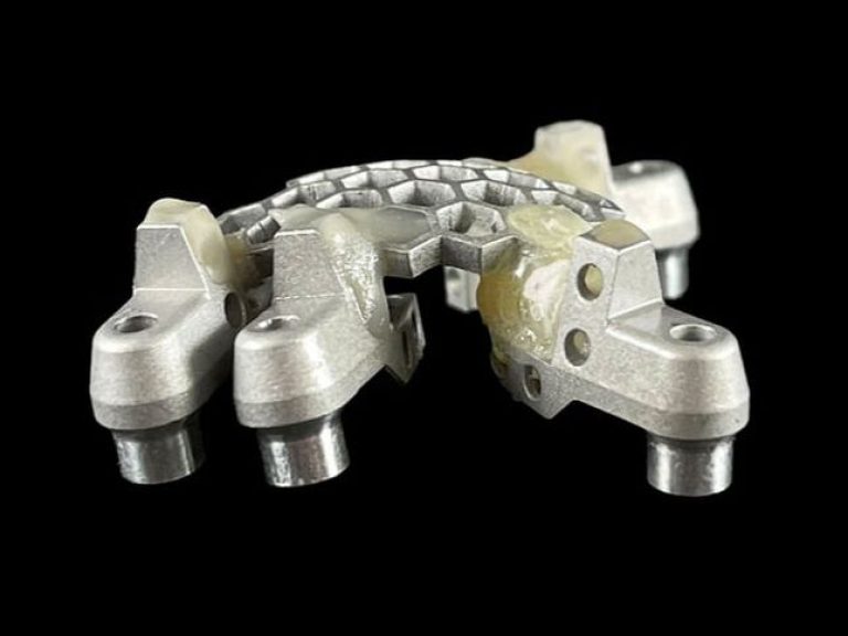 Thành phần implant cá nhân hóa